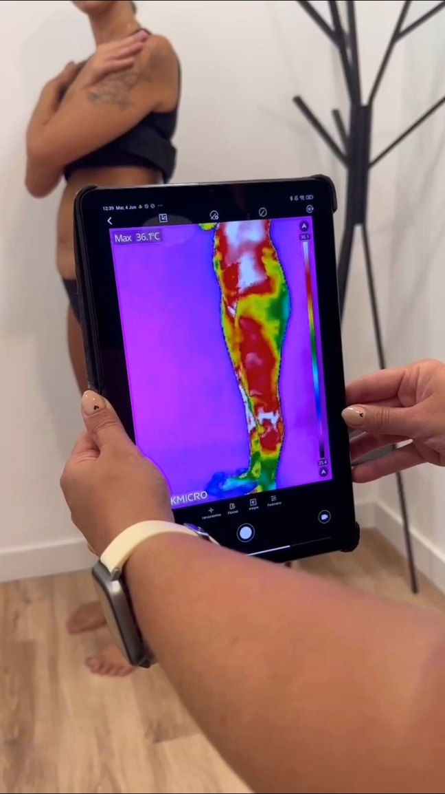 Imagen termográfica de una pierna en la pantalla de una tableta