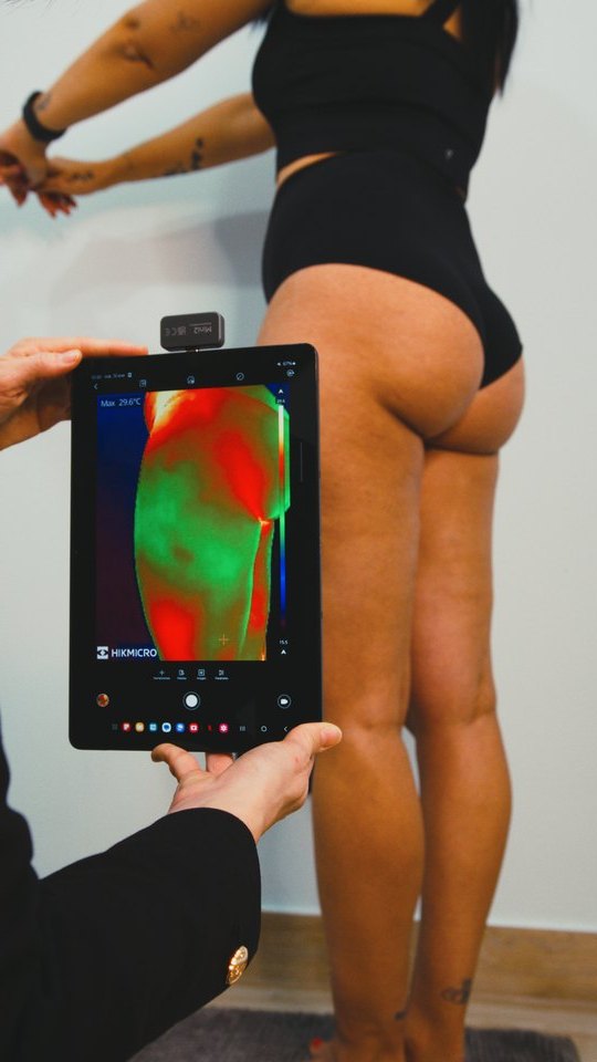 Esteticista mostrando la imagen termográfica de los glúteos de una clienta en una tableta