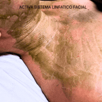 Terapia Enzimática para pieles deshidratadas y acné - Imagen 2